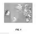 Fig. 02 - TUMOR CELL ISOLATION/PURIFICATION PROCESS AND METHODS FOR USE THEREOF