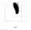 Fig. 12 - Method for determining volume and hemoglobin content of individual red blood cells