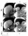 Fig. 07 - Accuracy and off-resonance performance in quantitative magnetization prepared magnetic resonance imaging