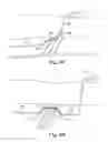 Fig. 05 - OBSTRUCTION OVERLAY CABLE