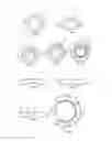 Fig. 02 - Multi-element lens of controlling defocus and eye diopter and application thereof