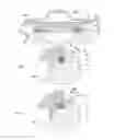 Fig. 06 - EXPANSION VALVE