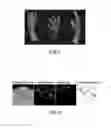 Fig. 08 - Information processing apparatus, information processing method and program to recognize an object from a captured image
