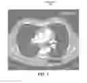 Fig. 02 - Generating an anatomical model using a rule-based segmentation and classification process
