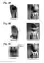 Fig. 04 - Motion tracking and image recognition of hand gestures to animate a digital puppet, synchronized with recorded audio