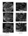 Fig. 11 - Method and system for performing rendering using first and second projections
