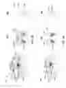 Fig. 04 - Channel strain inducing architecture and doping technique at replacement poly gate (RPG) stage