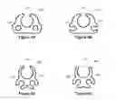 Fig. 08 - SYSTEMS FOR EARPHONE CABLE MANAGEMENT