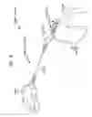 Fig. 03 - Hearing prosthesis accessory