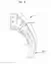 Fig. 08 - Hearing prosthesis accessory