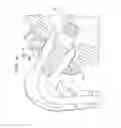 Fig. 12 - Hearing prosthesis accessory