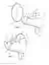 Fig. 02 - RETRIEVABLE OBJECTS AND THROWING DEVICES FOR THROWING THE RETRIEVABLE OBJECTS