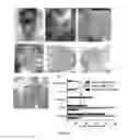 Fig. 03 - Mammal with an orthotopic tumor capable of metastasis, a method of making and a method of using