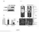 Fig. 12 - Mammal with an orthotopic tumor capable of metastasis, a method of making and a method of using