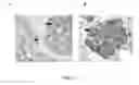 Fig. 13 - Mammal with an orthotopic tumor capable of metastasis, a method of making and a method of using