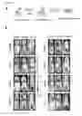 Fig. 15 - Mammal with an orthotopic tumor capable of metastasis, a method of making and a method of using