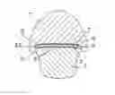 Fig. 01 - Injection molded part
