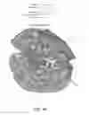 Fig. 07 - MULTIMODAL IMAGING FOR THE DETECTION OF TISSUE STRUCTURE AND COMPOSITION