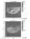 Fig. 09 - MULTIMODAL IMAGING FOR THE DETECTION OF TISSUE STRUCTURE AND COMPOSITION