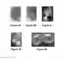 Fig. 09 - Systems and methods for visualizing ablated tissue