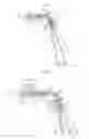 Fig. 04 - Optical speculum