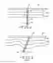 Fig. 03 - Implantable neural interface device with a deformable carrier
