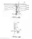 Fig. 05 - Implantable neural interface device with a deformable carrier