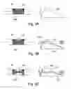 Fig. 03 - INTELLIGENT IMPLANTED HEALTH SENSING DEVICE AND ASSEMBLY