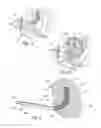 Fig. 02 - Devices, systems, and methods for diagnosis and treatment of overactive bladder