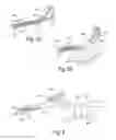 Fig. 04 - Devices, systems, and methods for diagnosis and treatment of overactive bladder