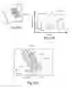 Fig. 12 - Devices, systems, and methods for diagnosis and treatment of overactive bladder