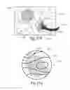 Fig. 16 - Devices, systems, and methods for diagnosis and treatment of overactive bladder