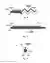 Fig. 06 - APPARATUSES FOR POSITIONING WITHIN AN INTERNAL CHANNEL