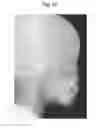 Fig. 22 - X-ray radiographic apparatus, method of measuring head tilt in taking radiograph, stand for X-ray radiographic apparatus, chair for X-ray radiographic apparatus, and head tilt setting device