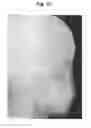 Fig. 32 - X-ray radiographic apparatus, method of measuring head tilt in taking radiograph, stand for X-ray radiographic apparatus, chair for X-ray radiographic apparatus, and head tilt setting device