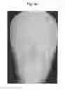 Fig. 33 - X-ray radiographic apparatus, method of measuring head tilt in taking radiograph, stand for X-ray radiographic apparatus, chair for X-ray radiographic apparatus, and head tilt setting device