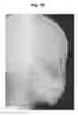Fig. 40 - X-ray radiographic apparatus, method of measuring head tilt in taking radiograph, stand for X-ray radiographic apparatus, chair for X-ray radiographic apparatus, and head tilt setting device