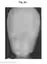 Fig. 41 - X-ray radiographic apparatus, method of measuring head tilt in taking radiograph, stand for X-ray radiographic apparatus, chair for X-ray radiographic apparatus, and head tilt setting device