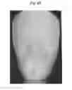 Fig. 43 - X-ray radiographic apparatus, method of measuring head tilt in taking radiograph, stand for X-ray radiographic apparatus, chair for X-ray radiographic apparatus, and head tilt setting device