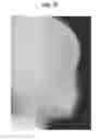 Fig. 48 - X-ray radiographic apparatus, method of measuring head tilt in taking radiograph, stand for X-ray radiographic apparatus, chair for X-ray radiographic apparatus, and head tilt setting device