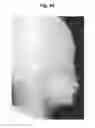 Fig. 50 - X-ray radiographic apparatus, method of measuring head tilt in taking radiograph, stand for X-ray radiographic apparatus, chair for X-ray radiographic apparatus, and head tilt setting device