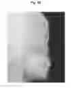 Fig. 67 - X-ray radiographic apparatus, method of measuring head tilt in taking radiograph, stand for X-ray radiographic apparatus, chair for X-ray radiographic apparatus, and head tilt setting device