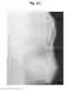 Fig. 68 - X-ray radiographic apparatus, method of measuring head tilt in taking radiograph, stand for X-ray radiographic apparatus, chair for X-ray radiographic apparatus, and head tilt setting device