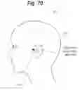 Fig. 71 - X-ray radiographic apparatus, method of measuring head tilt in taking radiograph, stand for X-ray radiographic apparatus, chair for X-ray radiographic apparatus, and head tilt setting device