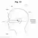 Fig. 74 - X-ray radiographic apparatus, method of measuring head tilt in taking radiograph, stand for X-ray radiographic apparatus, chair for X-ray radiographic apparatus, and head tilt setting device