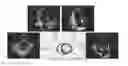 Fig. 01 - APPARATUS AND METHOD FOR PROCESSING ECHOCARDIOGRAM USING NAVIER-STOKES EQUATION