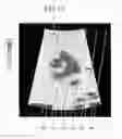 Fig. 14 - Ultrasonic diagnosis apparatus, image processing apparatus, and image processing method for tissue displacement caused by a shearwave generated by acoustic radiation force