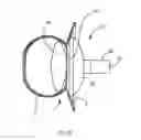Fig. 03 - Systems and Methods for Cerebrospinal Fluid Repair