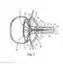 Fig. 05 - Systems and Methods for Cerebrospinal Fluid Repair