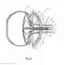 Fig. 06 - Systems and Methods for Cerebrospinal Fluid Repair
